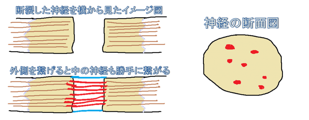 断裂した神経を横から見たイメージ図と断面図のイメージ